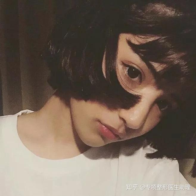 整容脸VS自然脸,到底选哪个?!