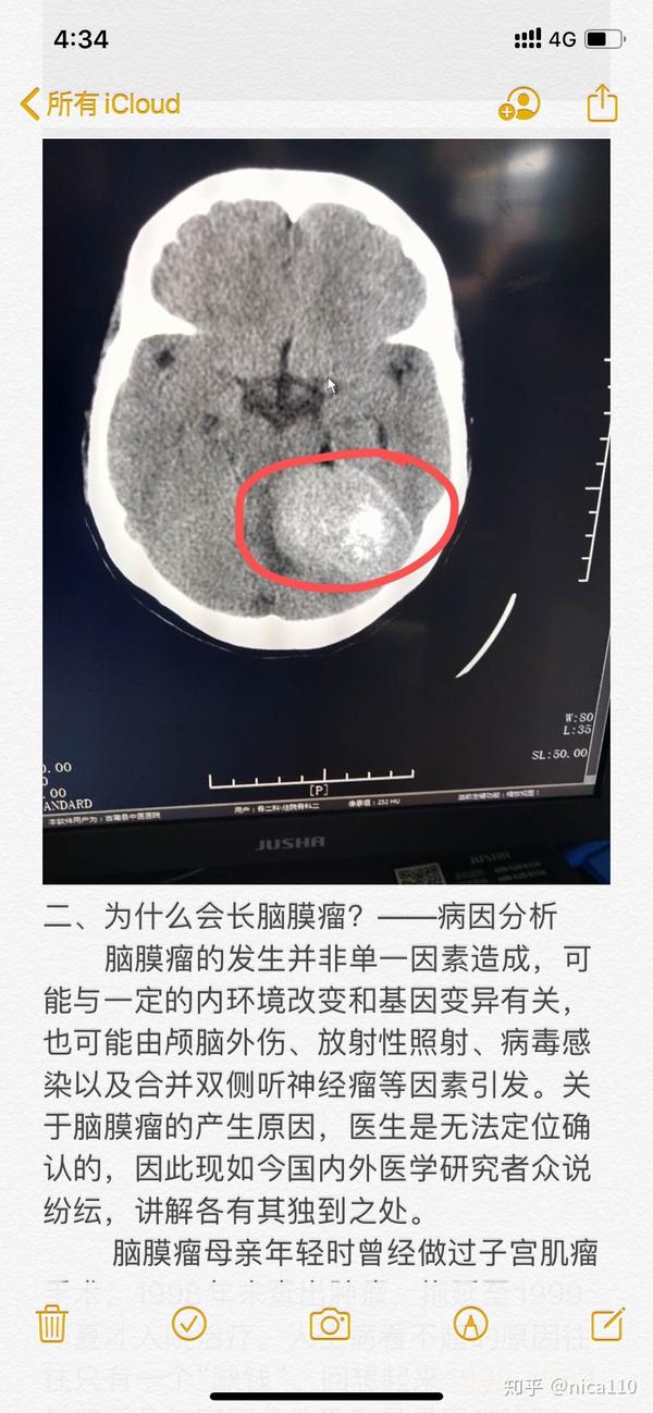 8年的脑膜瘤还有救吗?