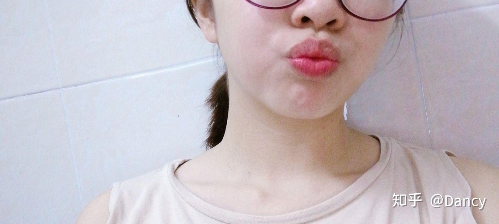 本人女生,对于自身嘴唇厚特别自卑怎么办?