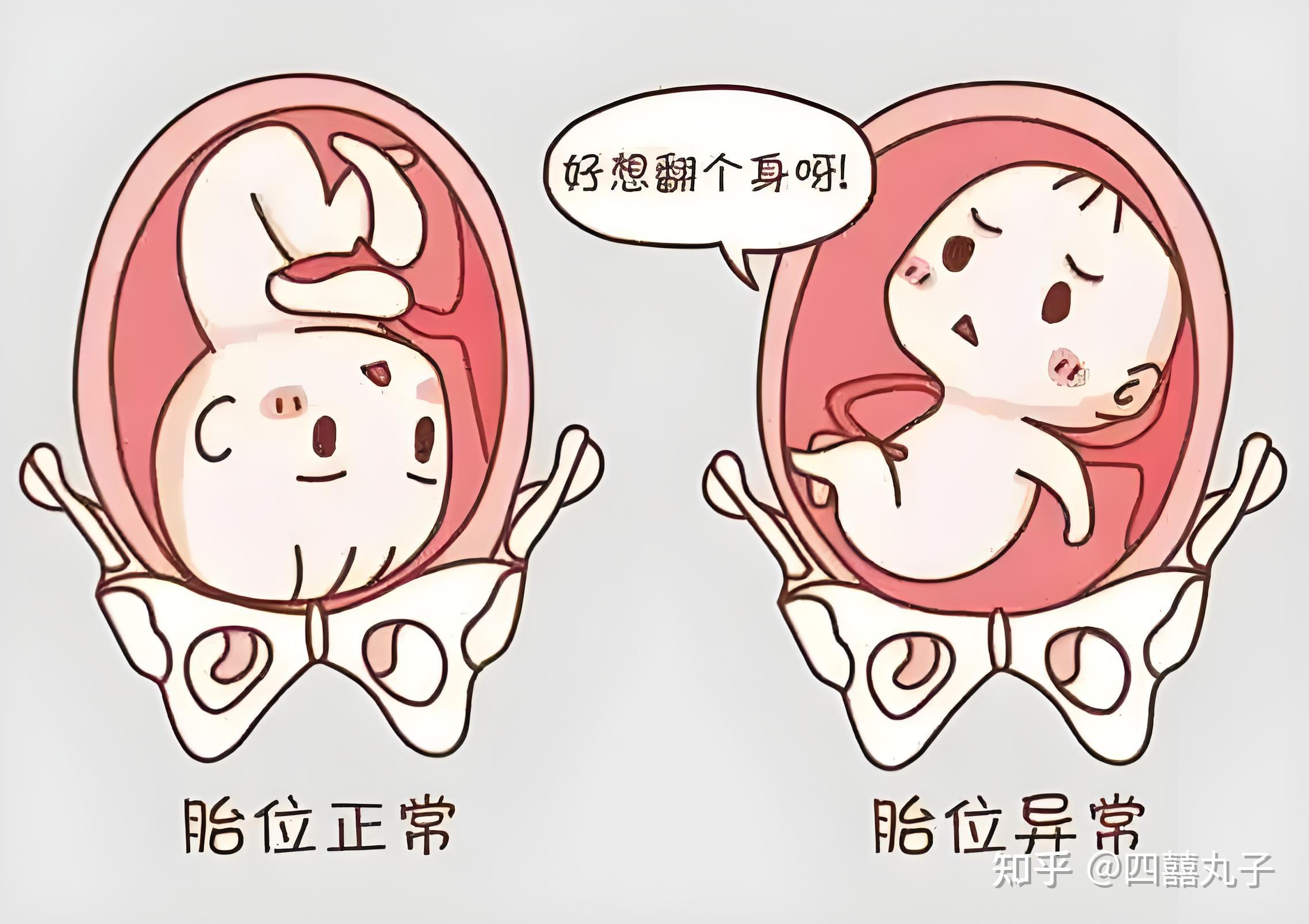 孕晚期,你一定要知道的胎位知识! - 知乎