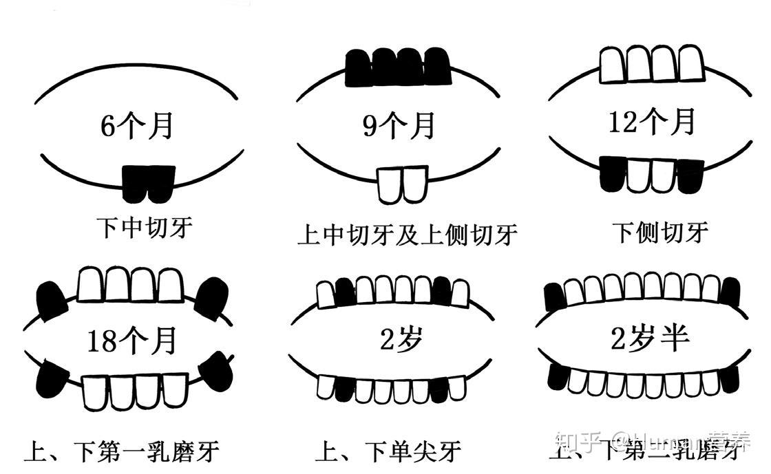 (2個)-下側切牙(2個)-第一乳磨牙(4個)-尖牙(4個)-第二乳磨牙(4個)(圖