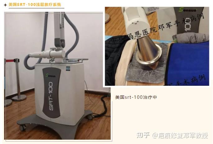 加快胶原纤维分解;相比同位素和直线加速器,srt-100在疤痕疙瘩的治疗