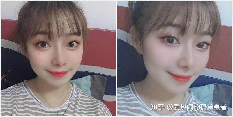 北京亲妈鼻自然直鼻测评