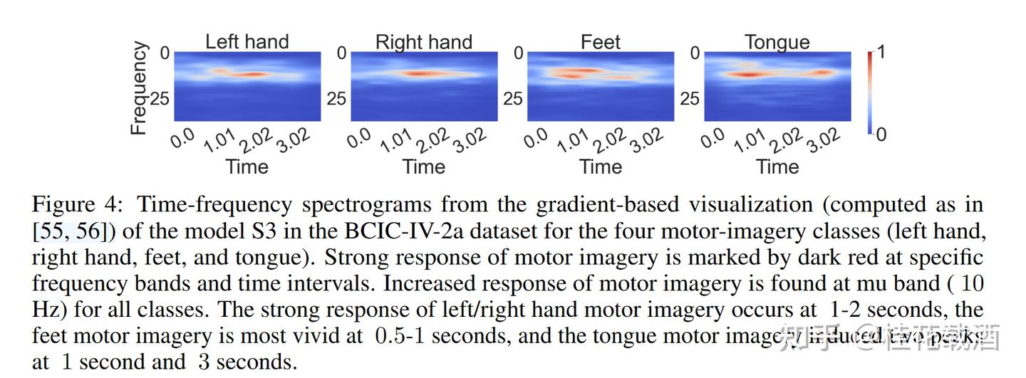 MAtt: A Manifold Attention Network for EEG Decoding阅读笔记 - 知乎