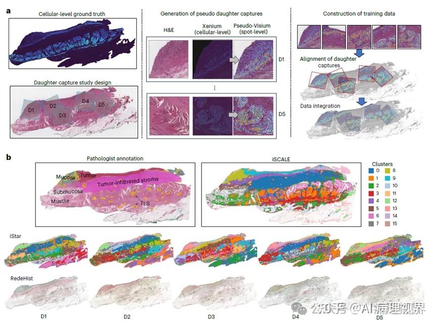 AI病理文摘 | Nature Methods同日“双黄蛋“：H&E切片预测空间转录组，研究热度空前 - 知乎