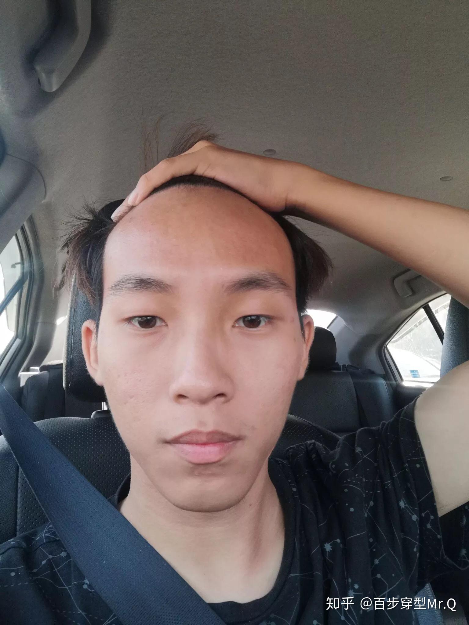 发际线很高的男人适合什么样的发型? - 知乎
