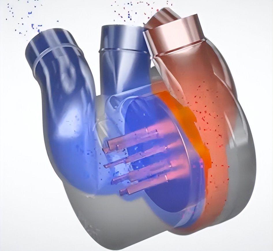 全球首个全人工心脏产业新布局