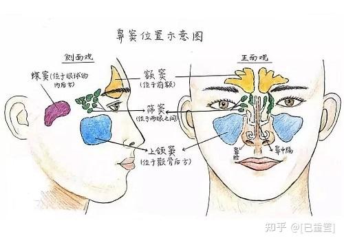 上颌窦炎是什么症状图片