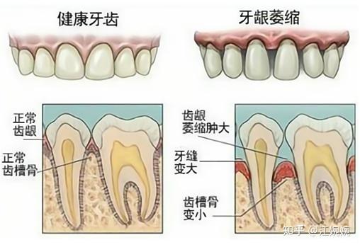 v2-4ffb661ded52c6ecdf9a80feef6914b2_r.jpg