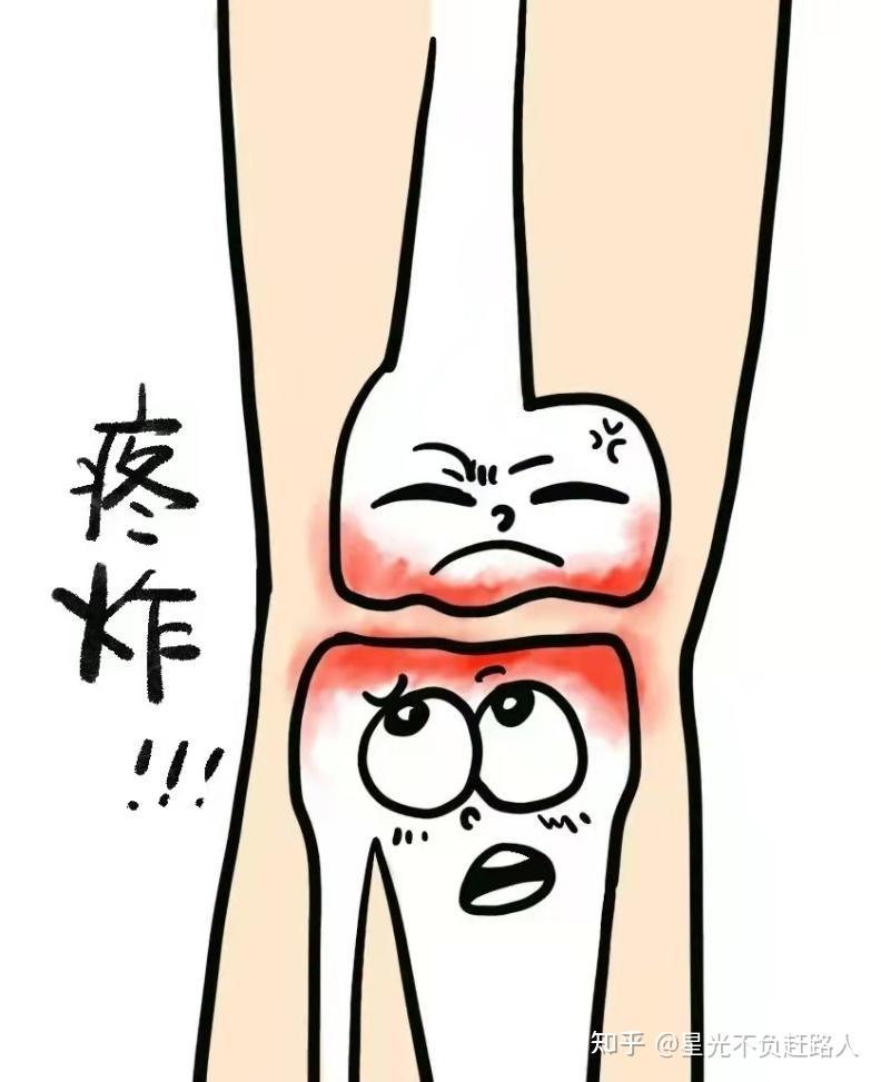膝关节炎卡通图片