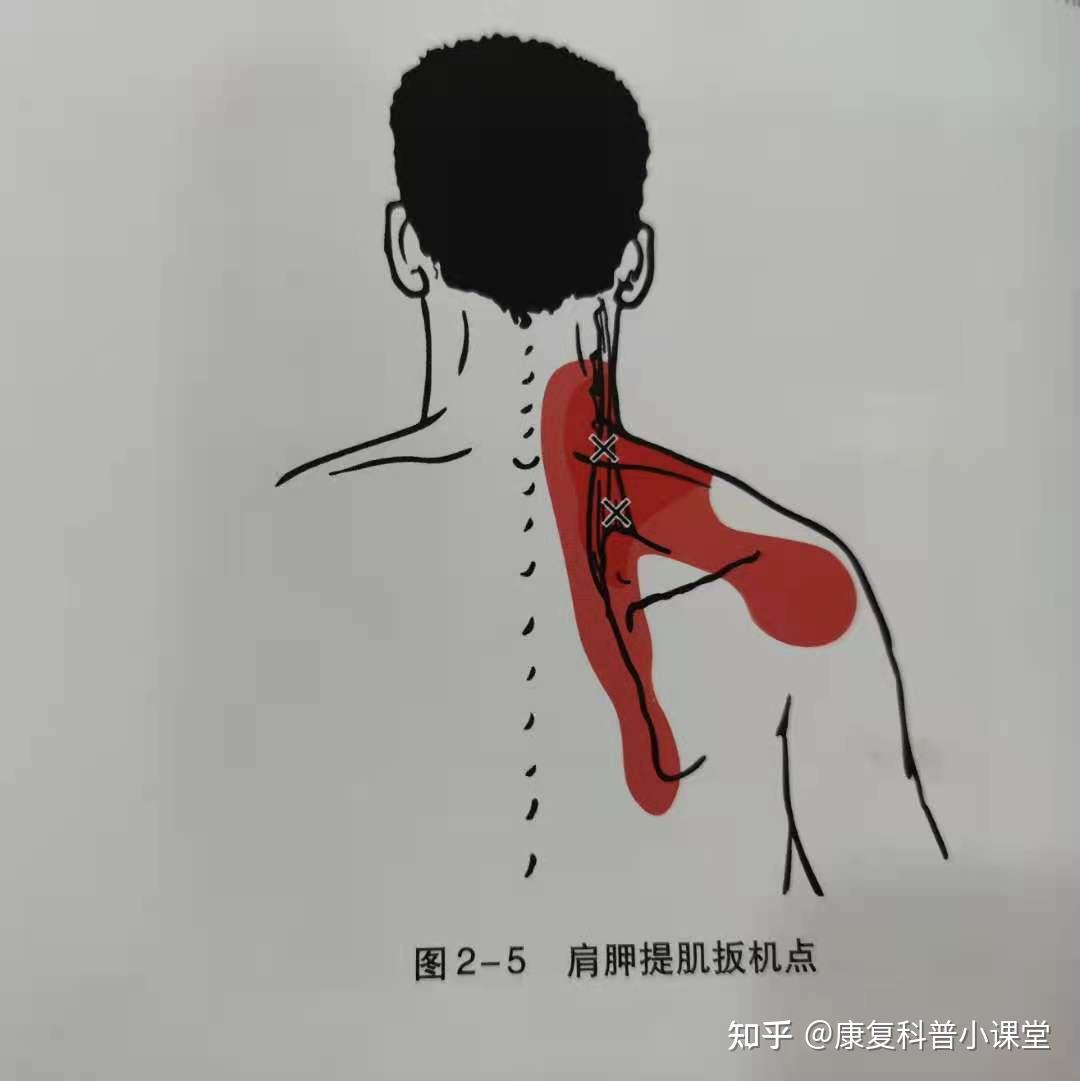 功能解剖學頸肩部肌肉