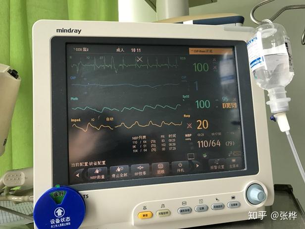 医理求真——西医:pci术后房颤,低血压4天/中医:亡阳证 - 知乎