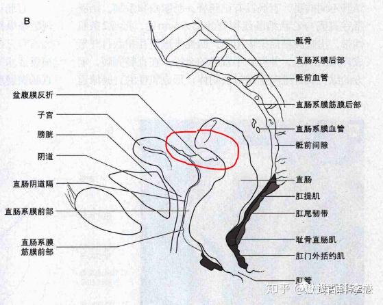 直肠系膜区解剖范围图片