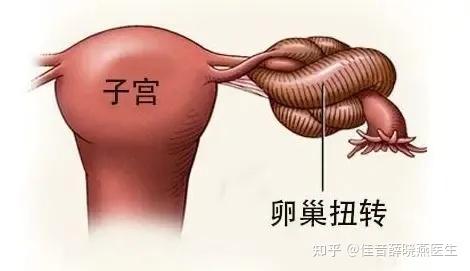 卵巢過度刺激幹啥都慢一點