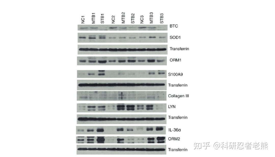 Western blot 实验大忌——稀里糊涂跑内参蛋白 - 知乎