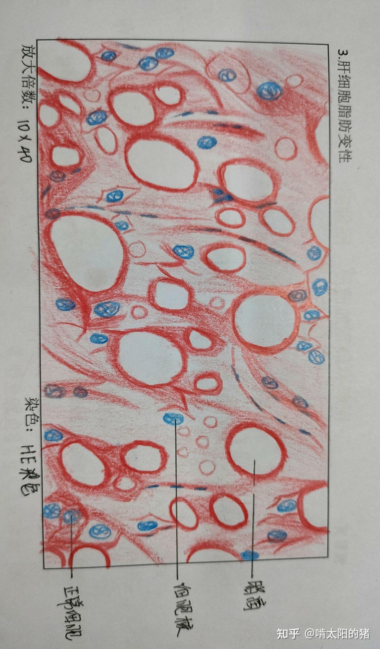 霍乱弧菌红蓝铅笔图片