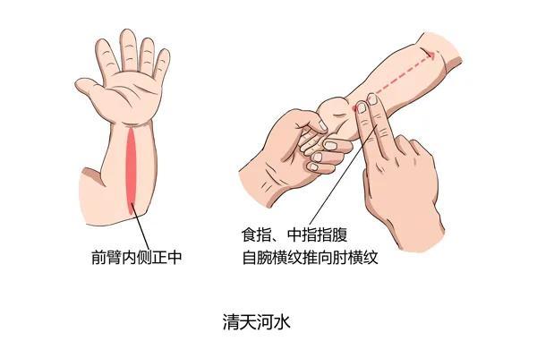 3 退六腑 在前臂外侧肘关节至小指侧手腕处