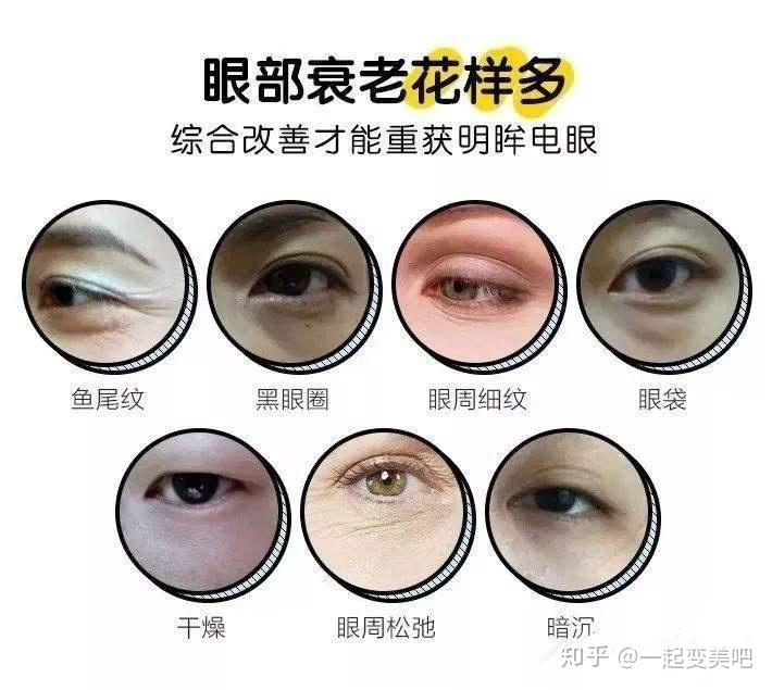 我们傲娇的眼周问题该如何解决