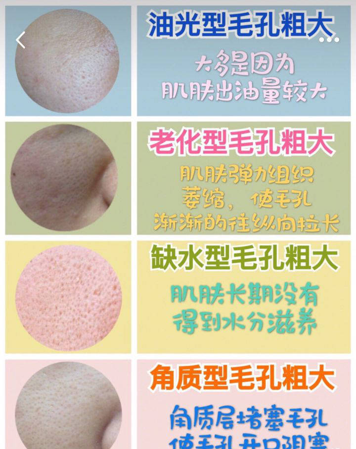 v2-51fc630c358eea107d939c5e45203cb3_1440w.jpg?source=172ae18b