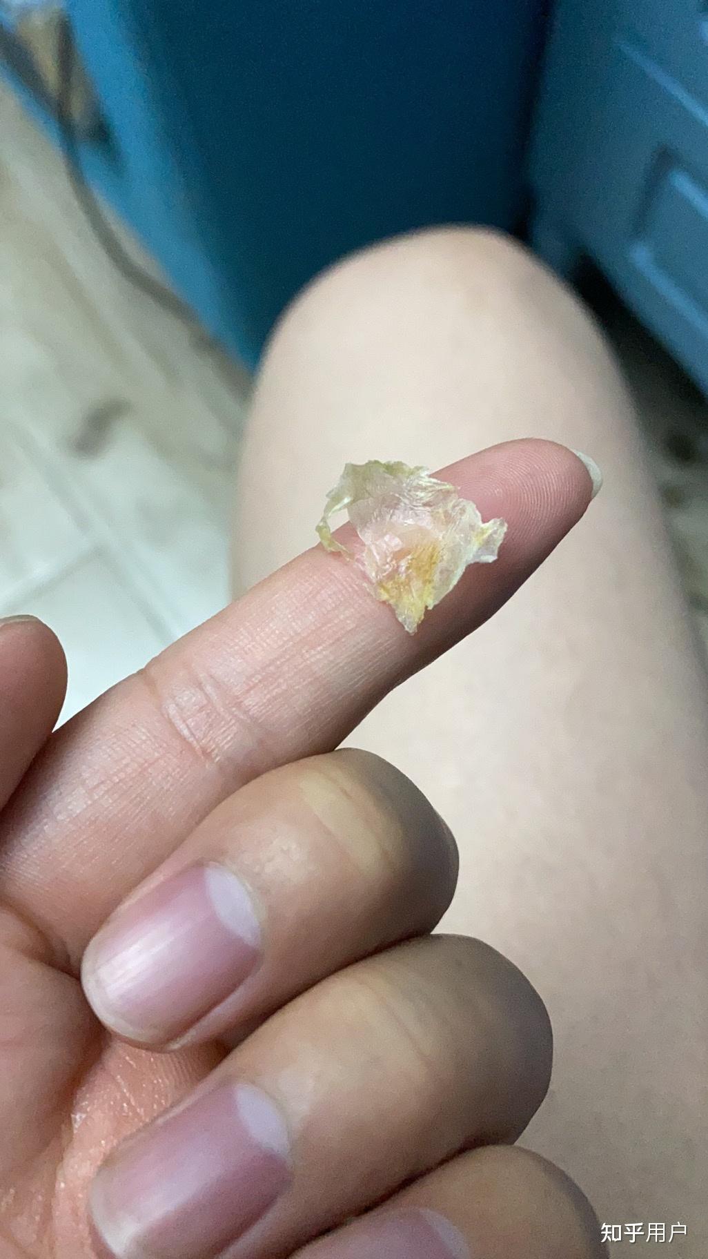 掏出一块超大耳屎是种什么体验