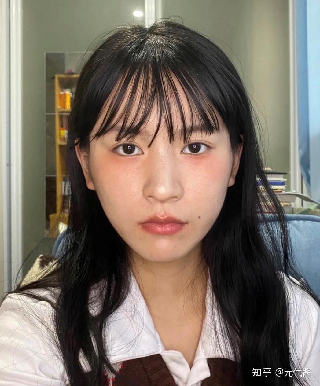 翻看以前的照片,一个单纯的下颌角变化好大,为什么没做颧骨,因为怕脸