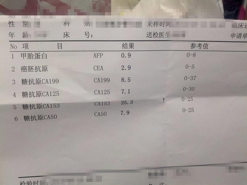 癌胚抗原多少才偏高算癌症 v2-525c6978681b4a0a1b0458a600207850_1440w.jpg?source=172ae18b