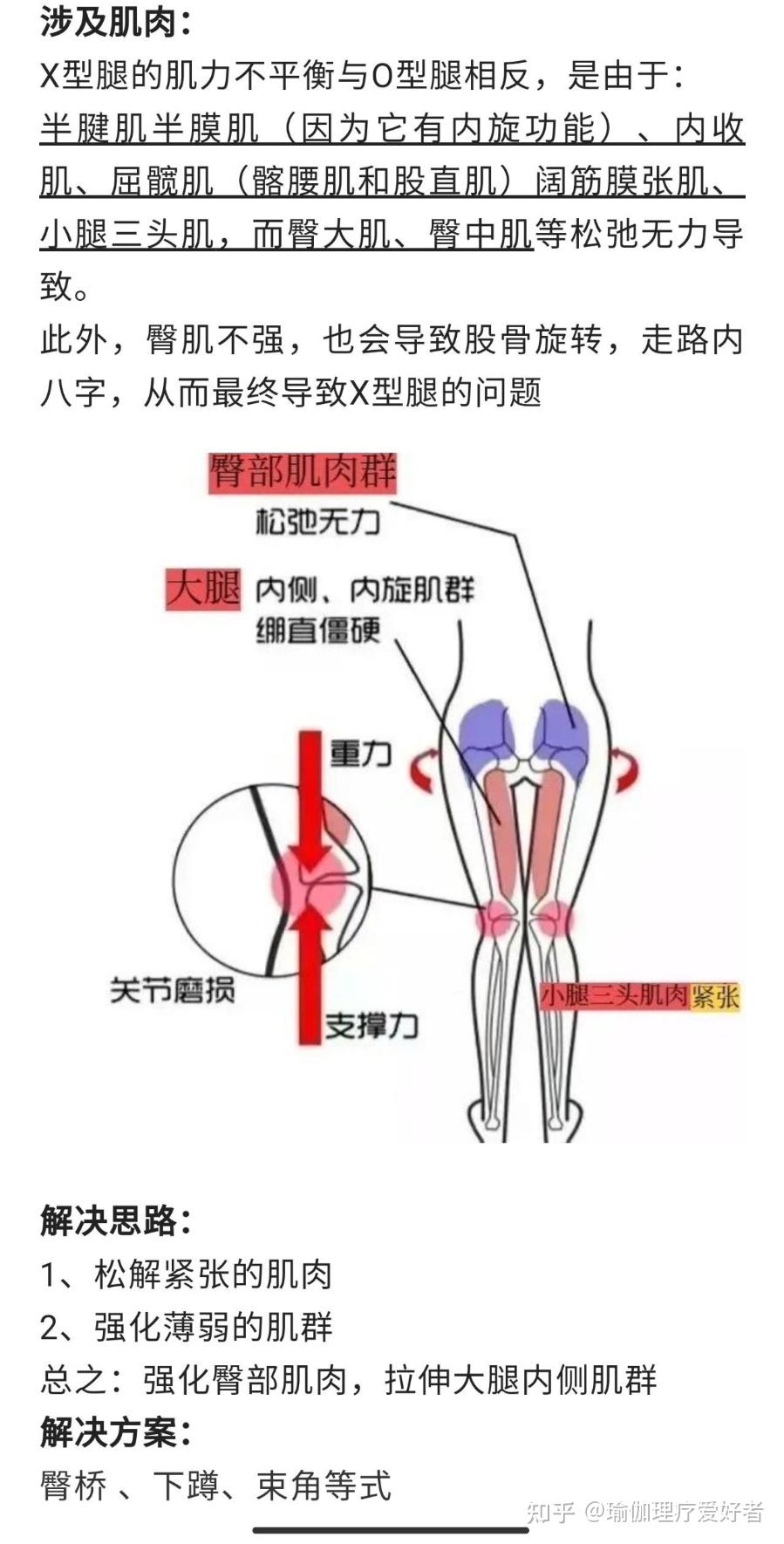 改善x型腿