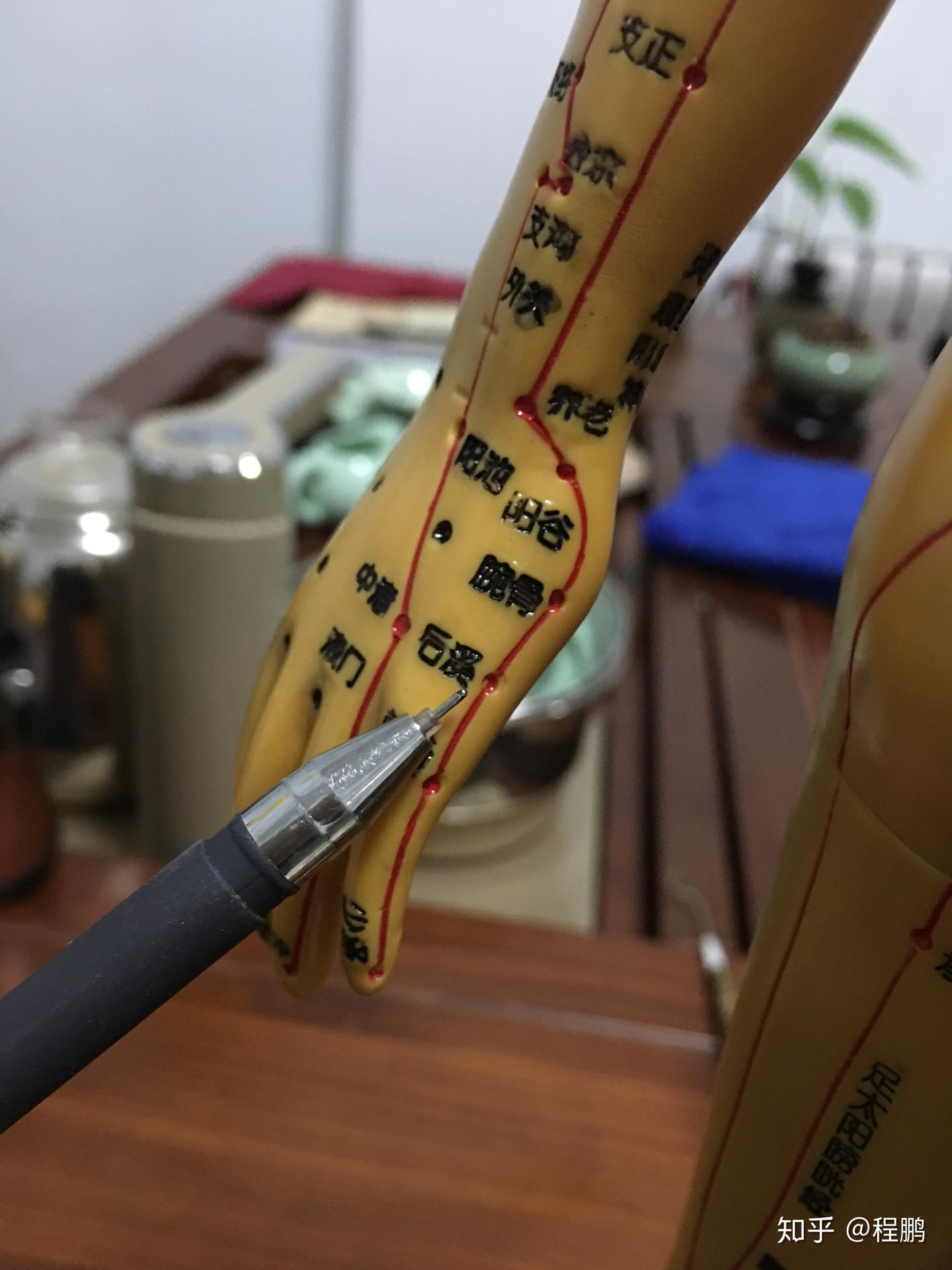 艾灸丨艾灸治疗颈椎病，这几个穴位最有效！ - 知乎