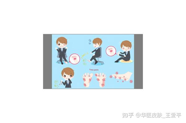 手足癣是如何引起的?记住这6个诱因。 - 知乎