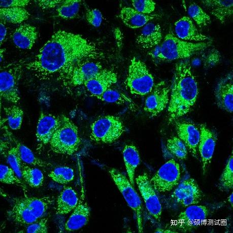 一文读懂激光共聚焦显微镜(lscm)!