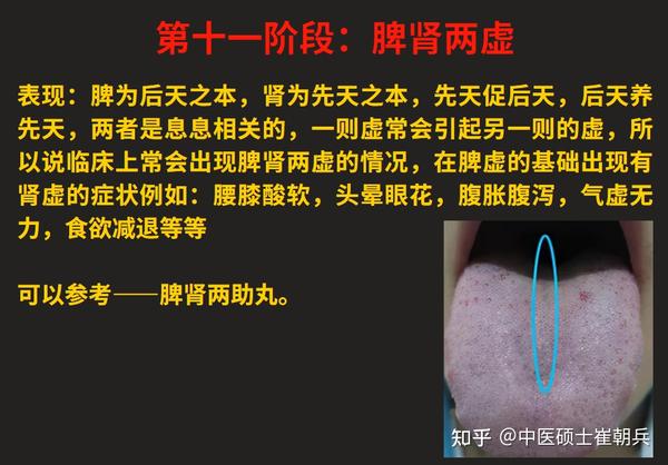 脾气虚、脾阳虚，由轻到重，看看自己的脾虚在哪个阶段？12个阶段的脾虚一次讲明白 - 知乎