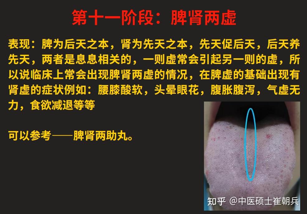 脾气虚、脾阳虚,由轻到重,看看自己的脾虚在哪个阶段?12个阶段的脾虚一次讲明白 - 知乎