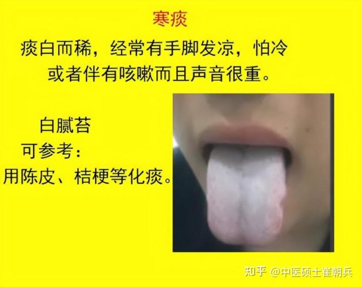 “痰”为百病之源!湿痰、寒痰、风痰、燥痰?中医:教你一招,“挖”走老痰 - 知乎