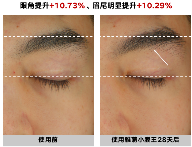 有什麼適合十六歲的眼霜黑眼圈和眼袋非常嚴重即使不