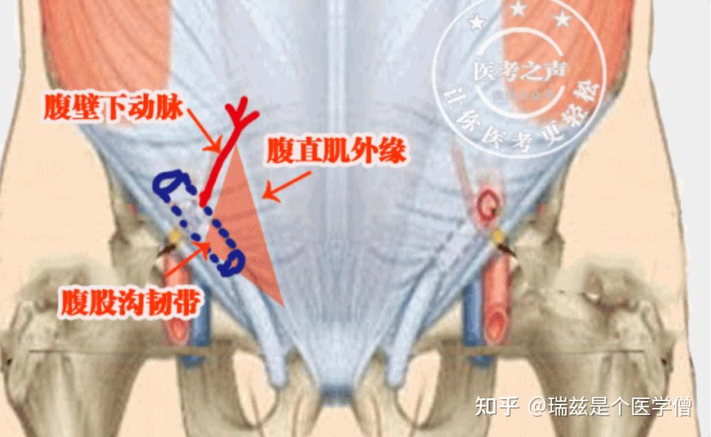 腹股沟解剖 和 腹股沟疝 ，学医这么多年终于搞懂了！ 知乎 