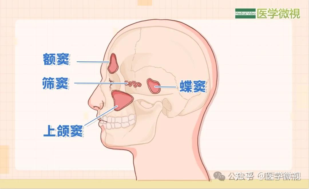 反复头痛,一查鼻子竟"发霉"了!