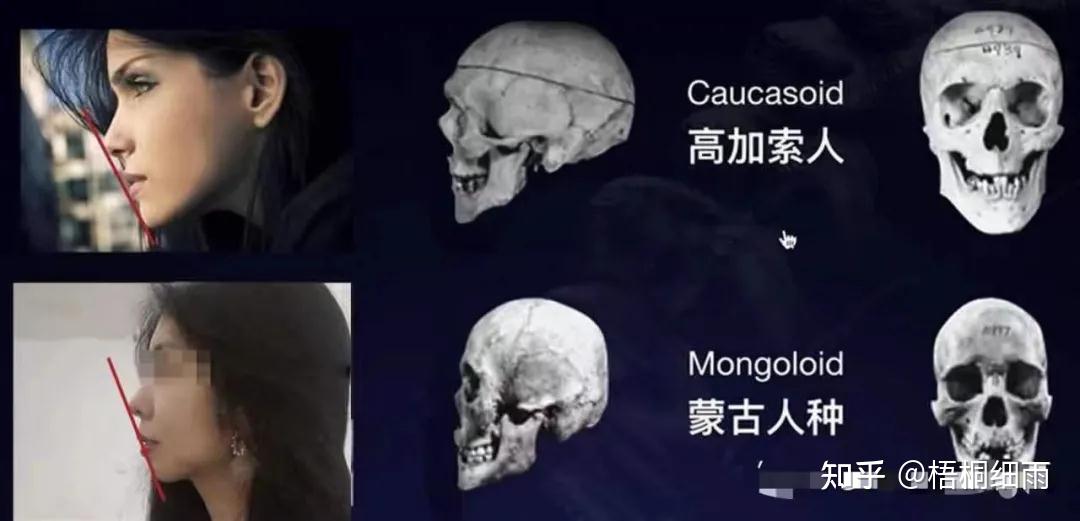 西方人多直面型高加索人种东方人多微凸面的蒙古人种出现龅牙,天包地