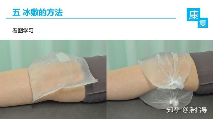 冰敷知识大全（原理／作用／冰袋制作／冰敷感觉／注意事项） - 知乎