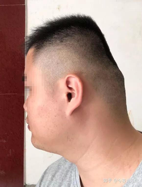 头扁是一种什么体验? - 知乎