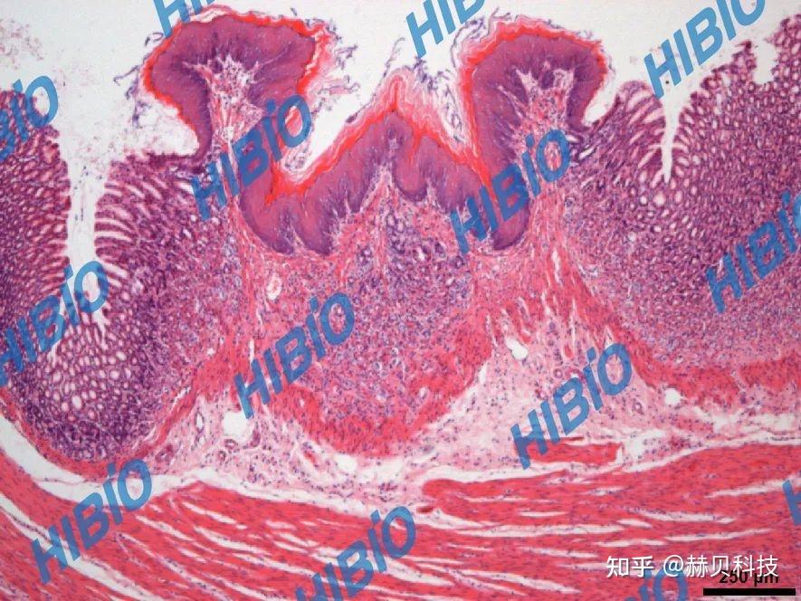 he染色:顯微鏡下檢查再生黏膜厚度,肉芽組織微血管數量,再生黏膜內呈