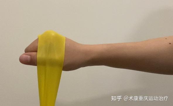 手腕骨折康复2｜smith骨折 知乎 