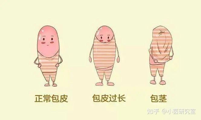 男性割完包皮后,会更厉害吗? - 知乎