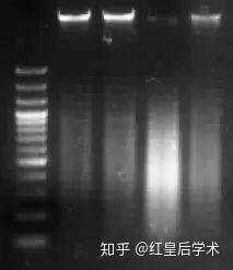琼脂糖凝胶电泳检测核酸提取效果 - 知乎