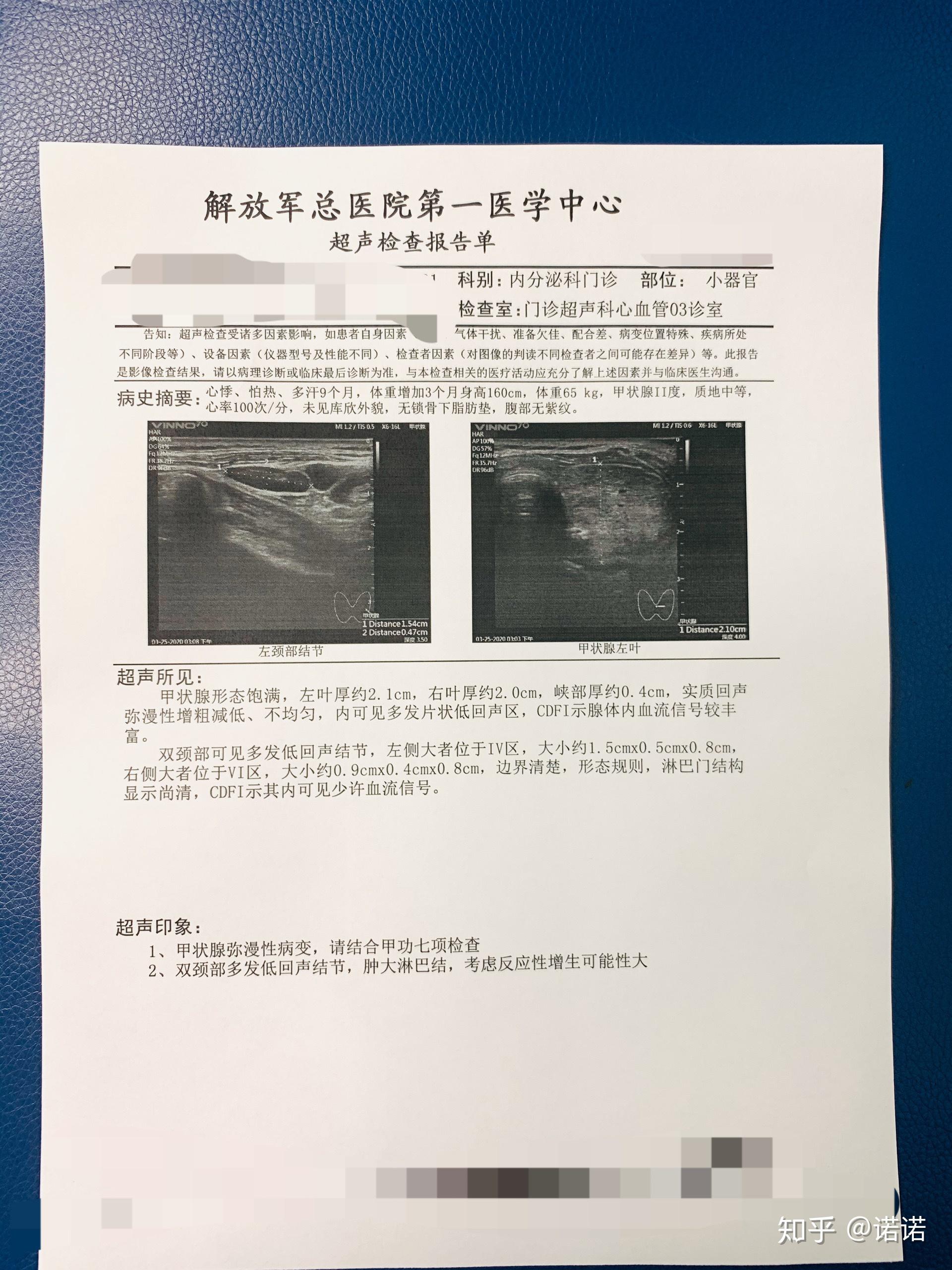 记录我的甲亢(完结)