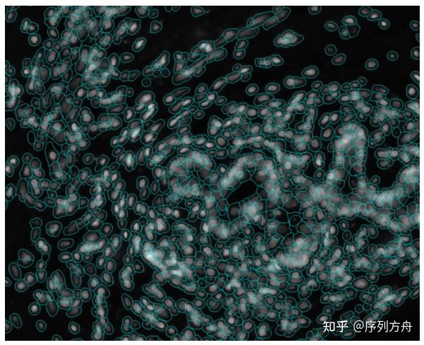 空间转录组的集大成者:NanoString CosMxTM Spatial Molecular Imager - 知乎