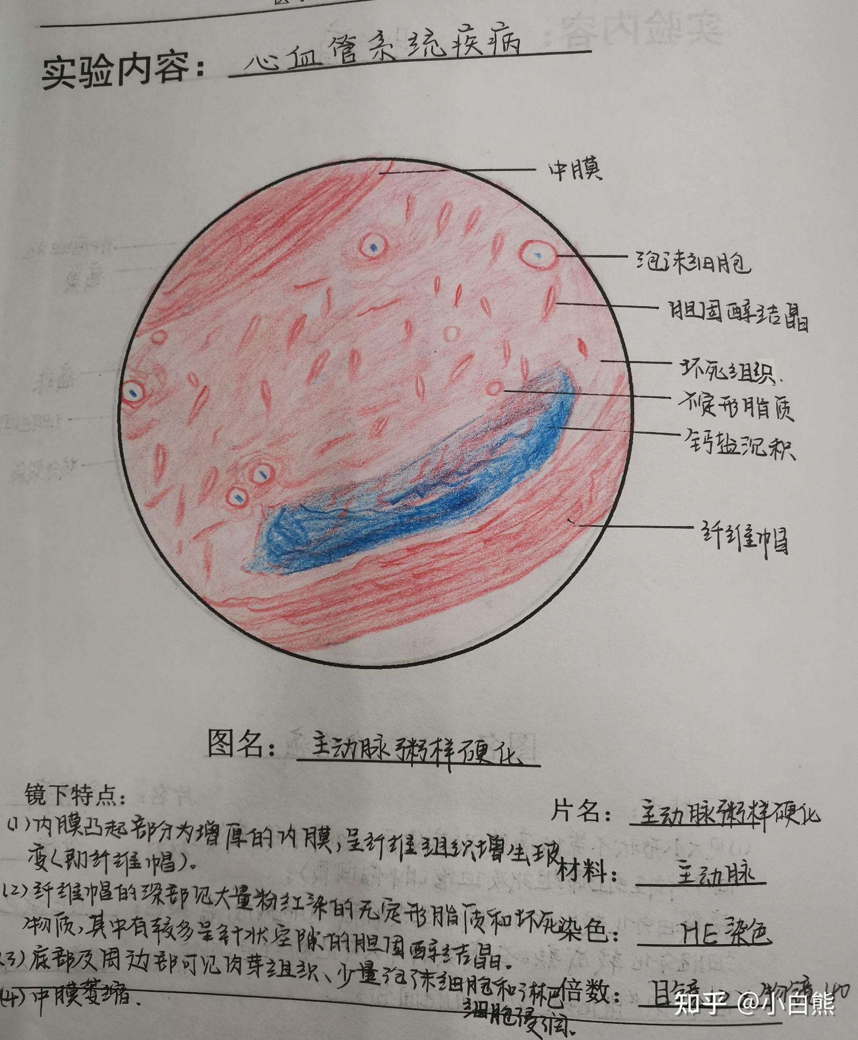 病理學實驗紅藍鉛筆繪圖