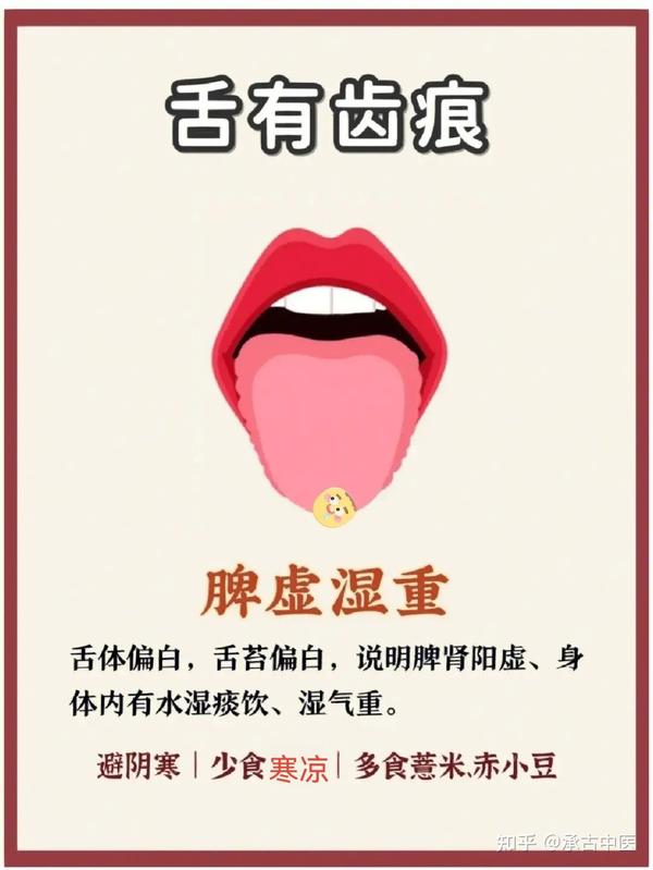 舌诊的原理 - 知乎