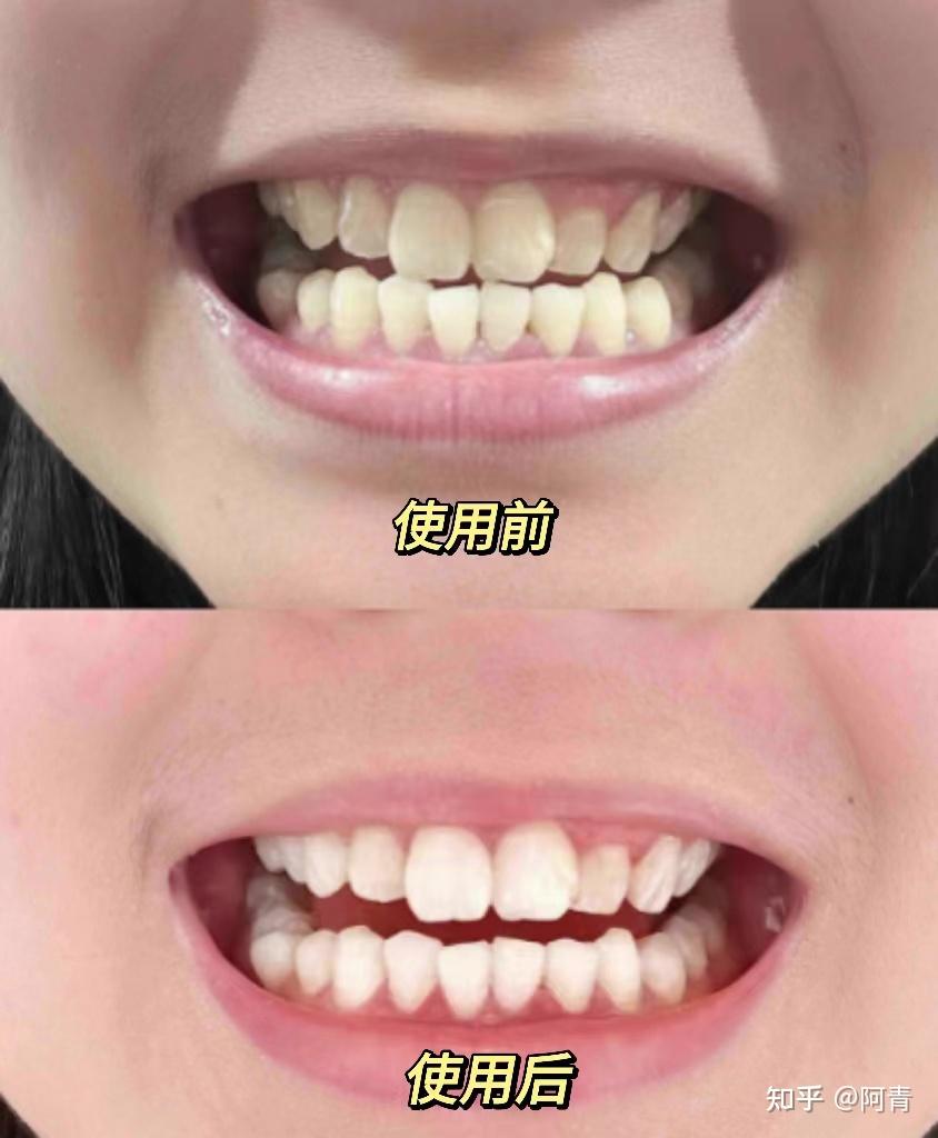 v2-550a6c1e255e8421e50e0ecd8d6272fe_r.jpg