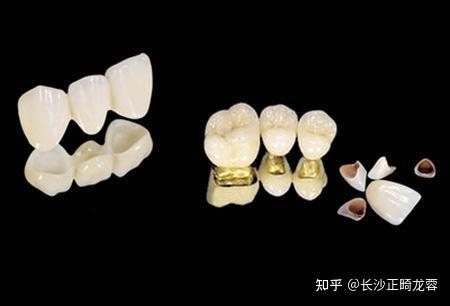 牙齿脱矿了怎么办?别慌,5种治疗方法教给你! - 知乎