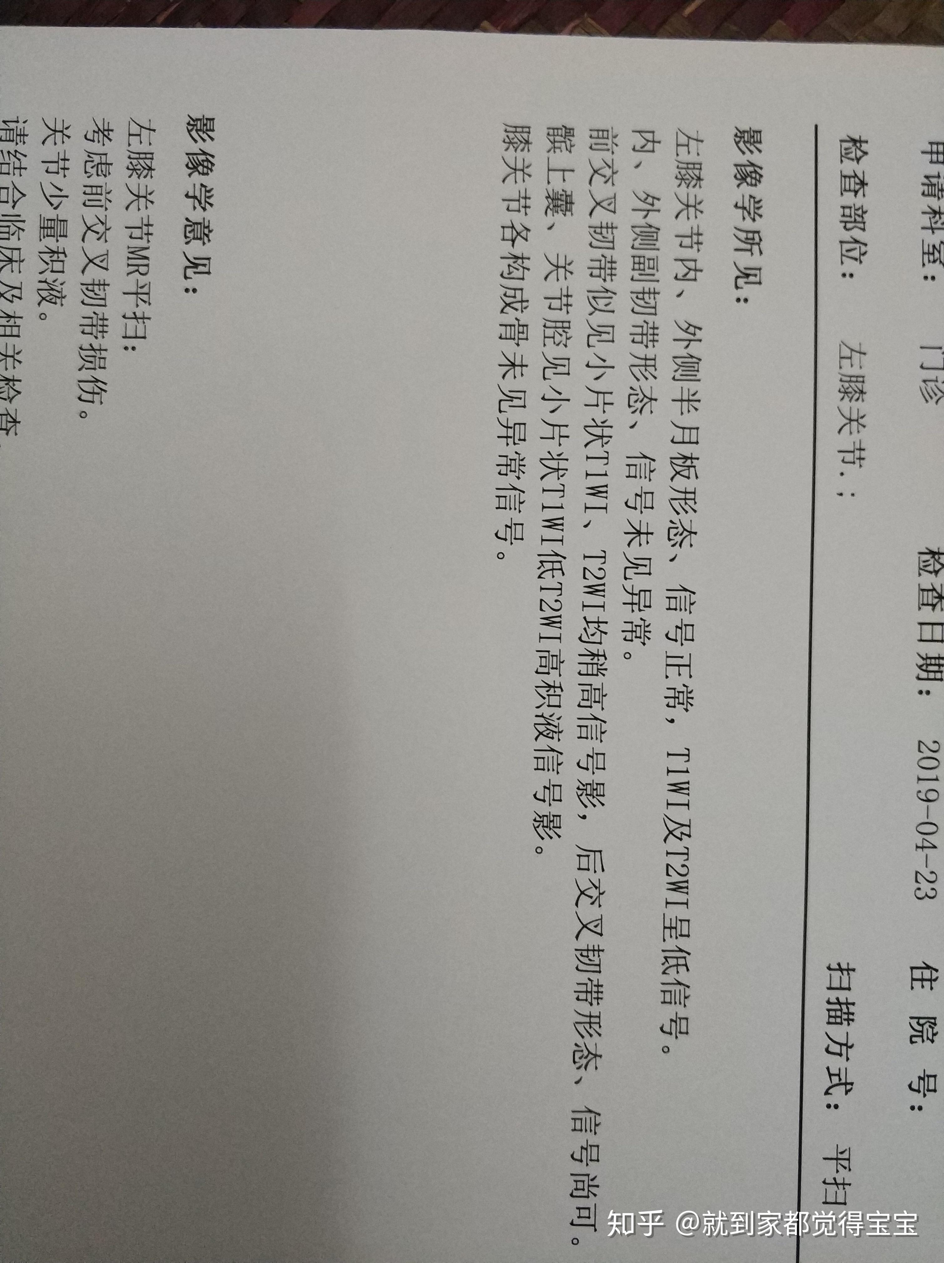 前交叉韧带损伤,有人可以帮我判断一下受伤的程度吗?